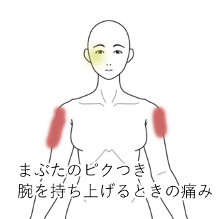 まぶたのピクピクと腕の痛み 愛知県安城市の鍼灸院 はりきゅう専門 鍼灸マッサージたかはし